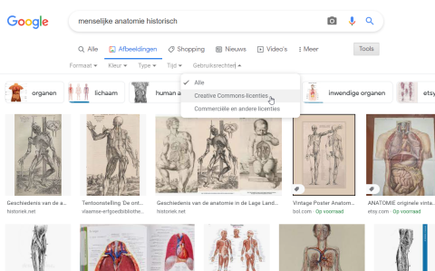 Schermafbeelding zoekopdracht Google 'menselijke anatomie historisch' - beeldlicenties